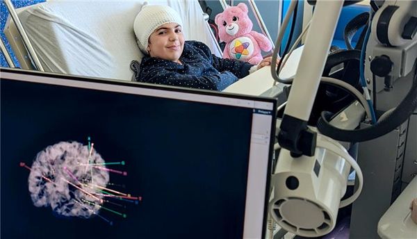 Delphyne, une jeune patiente qui, avant sa chirurgie, était atteinte d'une forme d'épilepsie ne répondant pas à la médication. Elle fait partie des 17 sujets qui ont prêté leur concours aux travaux de recherche de l'équipe de l'Université Laval. L'image sur l'écran montre l'emplacement des électrodes implantées dans son cerveau lors des examens préchirurgicaux visant à localiser le foyer épileptogène. 