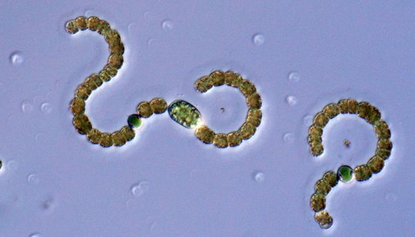 Ces cyanobactéries du genre Dolichospermum contribuent aux floraisons observées dans les lacs où le phosphore et l'azote abondent.